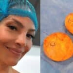 Implantes-Fabiola-DL