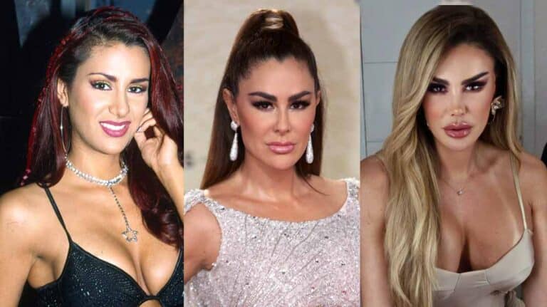 Experto revela las cirugías que transformaron por completo a Ninel Conde