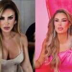 El especialista destaca el lip lift y el relleno labia, logrando un volumen equilibrado con ácido hialurónico para lograr un efecto más sensual