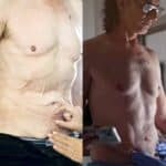 El actor mostró el antes y el después de  la abdominoplastia o tummy tuck que le hicieron para reconstruirle la pared abdominal porque la piel le colgaba de tanto que bajó