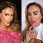 Ninel tenía los ojos marrones, y con la cirugía de keratopigmentación los transformó a verde olivo