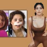 Gomita-anestesia-DL