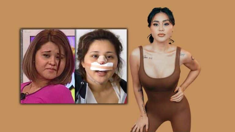 Gomita, adicta a la anestesia: “Era chidísimo porque me moría”