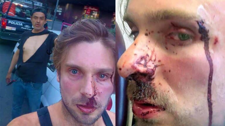 Brutal golpiza al actor de Televisa Joan Kuri: "Me sacó del carro y me golpeó"