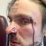 Tras el ataque del hombre, Kuri terminó con el rostro ensangrentado, el ojo izquierdo inflamado y varias heridas visibles en la cara