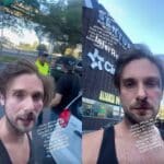 El actor confesó que le daba vergüenza mostrar cómo quedó tras la golpiza, pero que afortunadamente está bien y sólo le duele la boca al tratar de comer