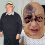 El comediante Luis de Ala sorprendió al compartir un video en el que se le ve con fuertes hematomas alrededor de ambos ojos, el puente de la nariz y parte de la frente